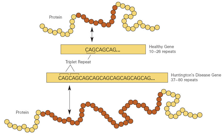 Diagram comparing normal CAG repeat count with the expanded repeat that causes Huntington's disease