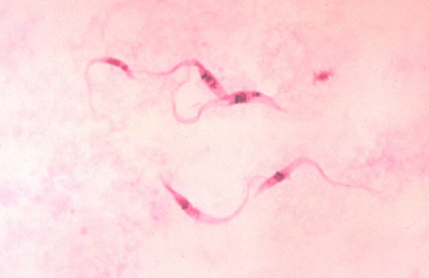 Trypanosoma cruzi parasites in a stained blood smear
