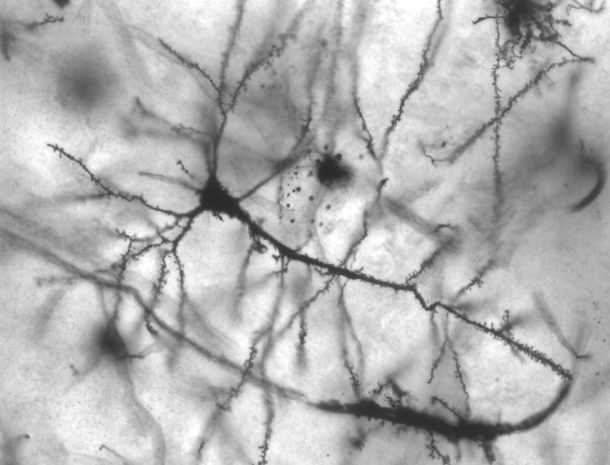 A pyramidal neuron from the hippocampus