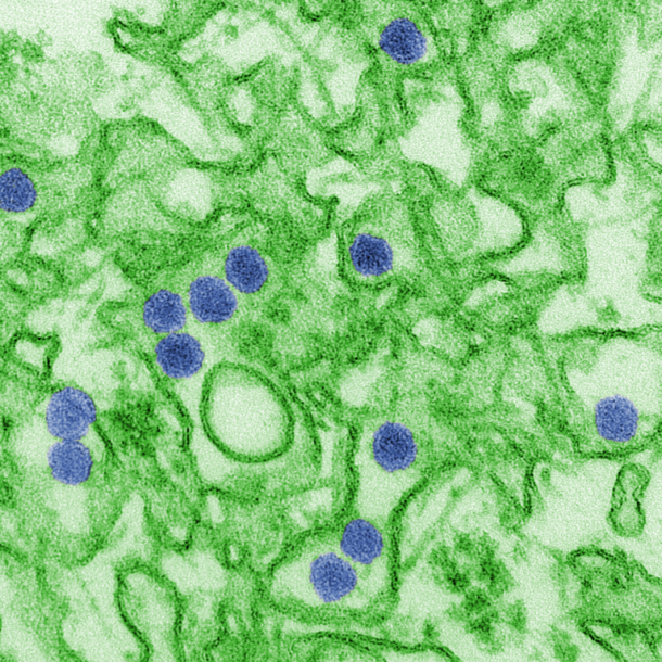Zika virus particles, transmission electron micrograph